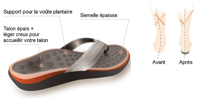 Fasciite plantaire sandales tongs